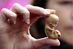 سقط‌های غیرقانونی چه تاثیری بر سلامت رحم دارند؟