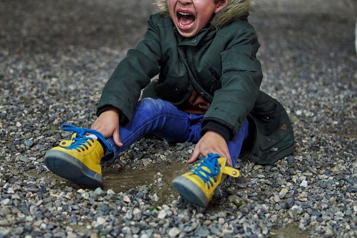 علت کج‌خلقی‌های مکرر در برخی از کودکان کشف شد.