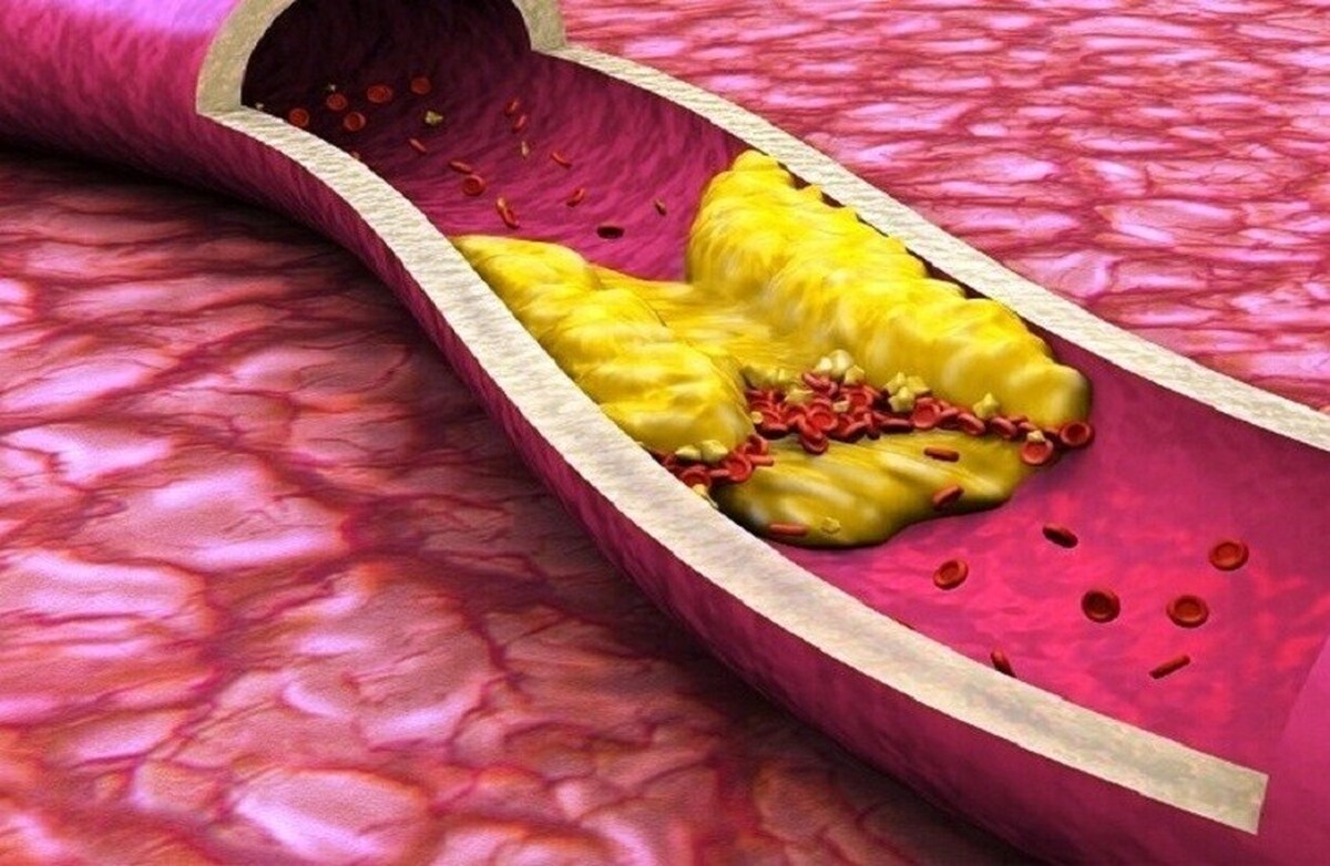میوه‌ای که کلسترول خون را کاهش می‌دهد