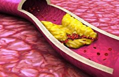 میوه‌ای که کلسترول خون را کاهش می‌دهد