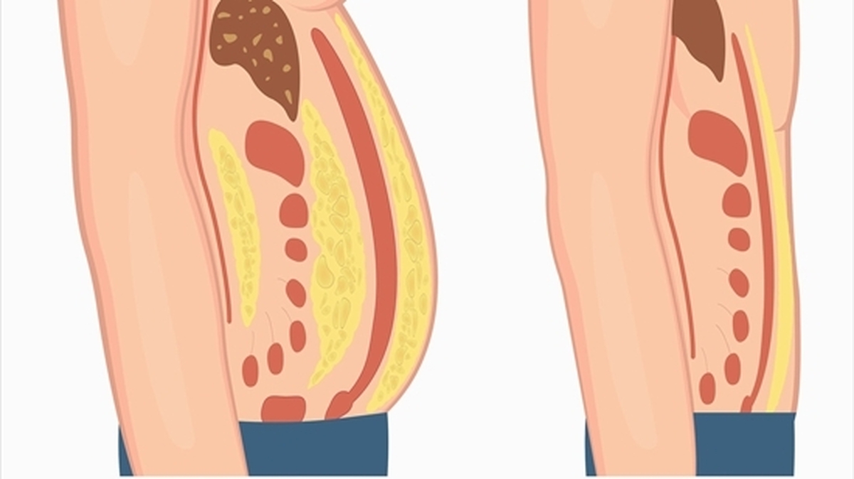 چربی احشایی بر مغز شما تاثیر میگذارد!