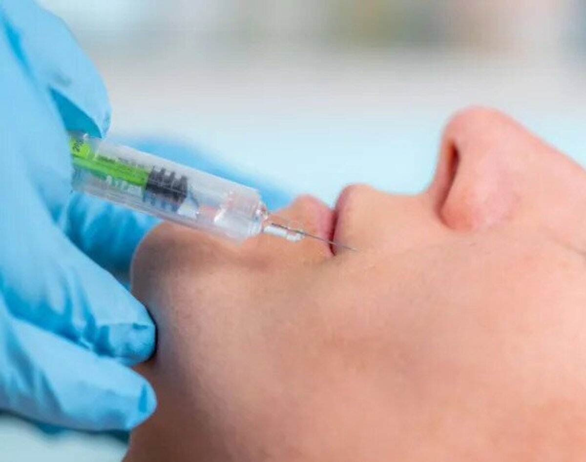 فکت خواندنی درباره تزریق فیلر پوستی و عوارض آن