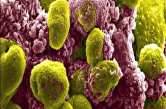 سرطان حاد پروستات قابل درمان است!