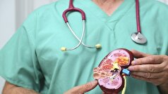 با نشانه‌های پنهان بیماری‌های کلیوی بیشتر آشنا شوید