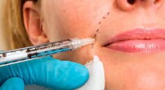 تزریق فیلر پوستی خطر دارد؟