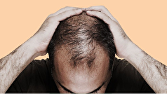 استرس میتواند علت ریزش مو باشد؟