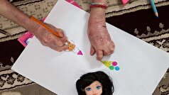 بنیاد امور بیماری‌های خاص به مطالبات بیماران پروانه‌ای پاسخی نمی‌دهد