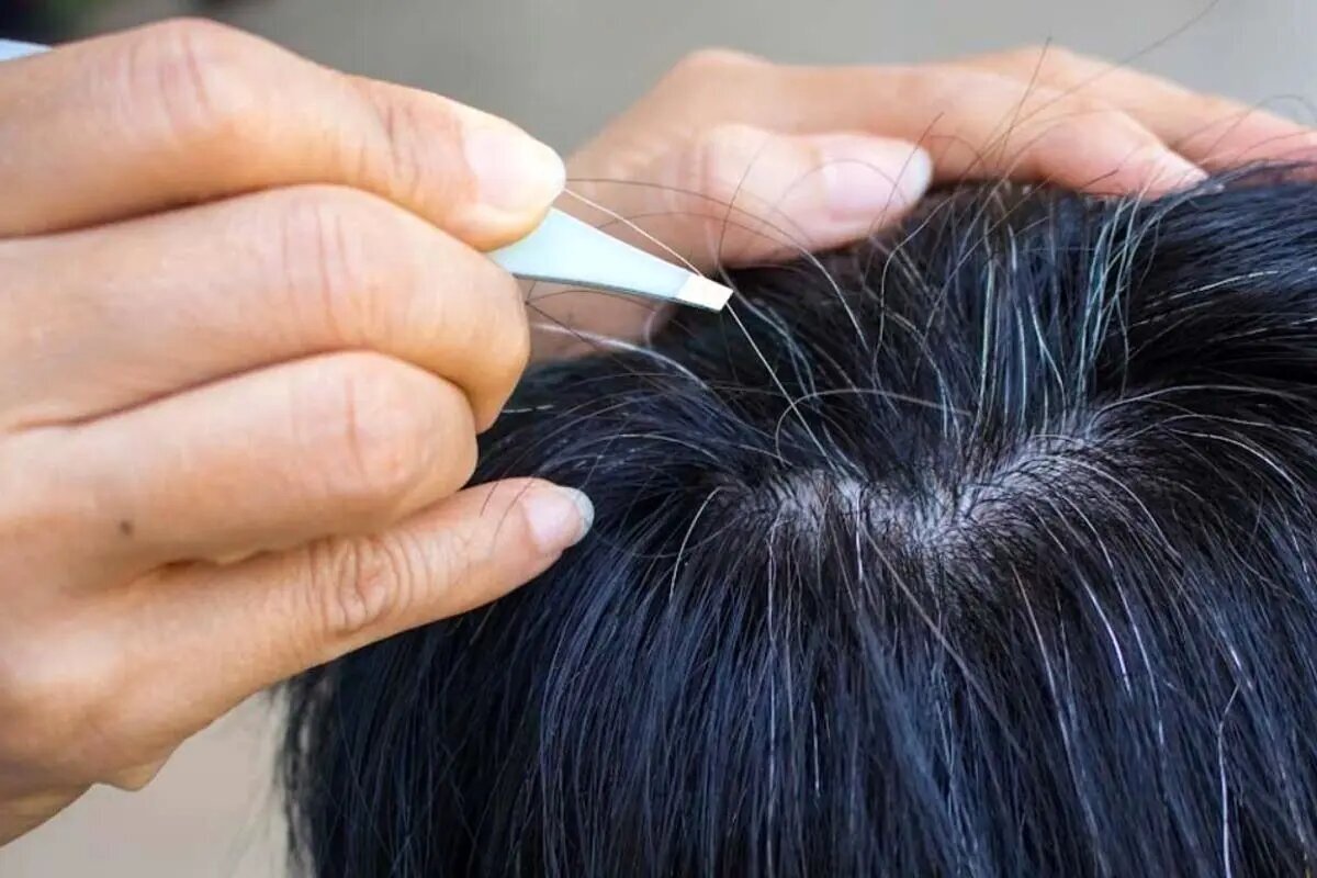 شناخت علت و پیشگیری از سفید شدن موها با کمک طب سنتی شناخت علت و پیشگیری از سفید شدن موها با کمک طب سنتی