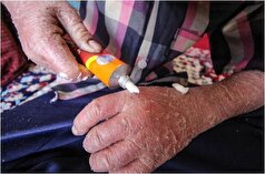 سرنوشت نوزاد پروانه‌ای رها شده در بیمارستان