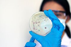 یک قارچ ۴۰۷ میلیون ساله در اسکاتلند کشف شد.