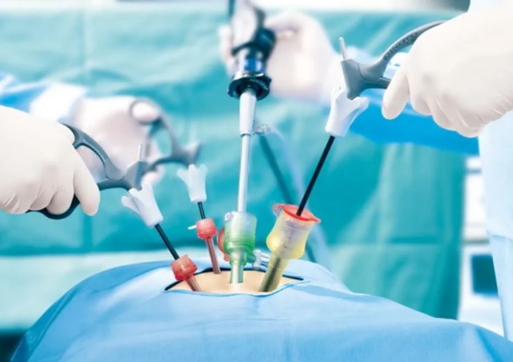 جراحی با روش لاپاراسکوپی یا لاپاراتومی/کدام بهتر است؟ جراحی با روش لاپاراسکوپی یا لاپاراتومی/کدام بهتر است؟