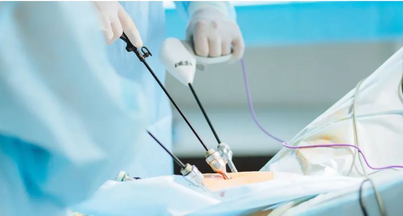 جراحی با روش لاپاراسکوپی یا لاپاراتومی/کدام بهتر است؟ جراحی با روش لاپاراسکوپی یا لاپاراتومی/کدام بهتر است؟