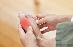 حقیقت نقرس کشف شد