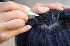 اگر میخواهید موی سفید نداشته باشید این مواد غذایی را بخورید!