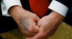 کاخ سفید چسب زخم روی دست ترامپ را به دست‌دادن‌های زیاد نسبت داد