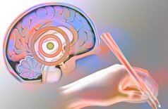 شاخص جدیدی برای بیماری پارکینسون