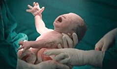 زایمان طبیعی و بدون درد چه محاسنی دارد؟