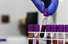 مقامات بهداشتی روسیه یک داروی ایمونوتراپی نوآورانه برای سرطان ریه را ثبت کردند که کاملاً در داخل کشور تولید خواهد شد