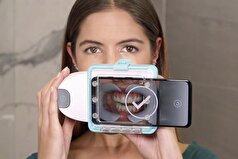 یک پزشک هشدار داد که بلع نادرست بزاق می‌تواند بر گاز گرفتن تأثیر بگذارد