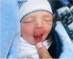 نوزاد به دنیا آمده با دندان در عراق خبرساز شد!