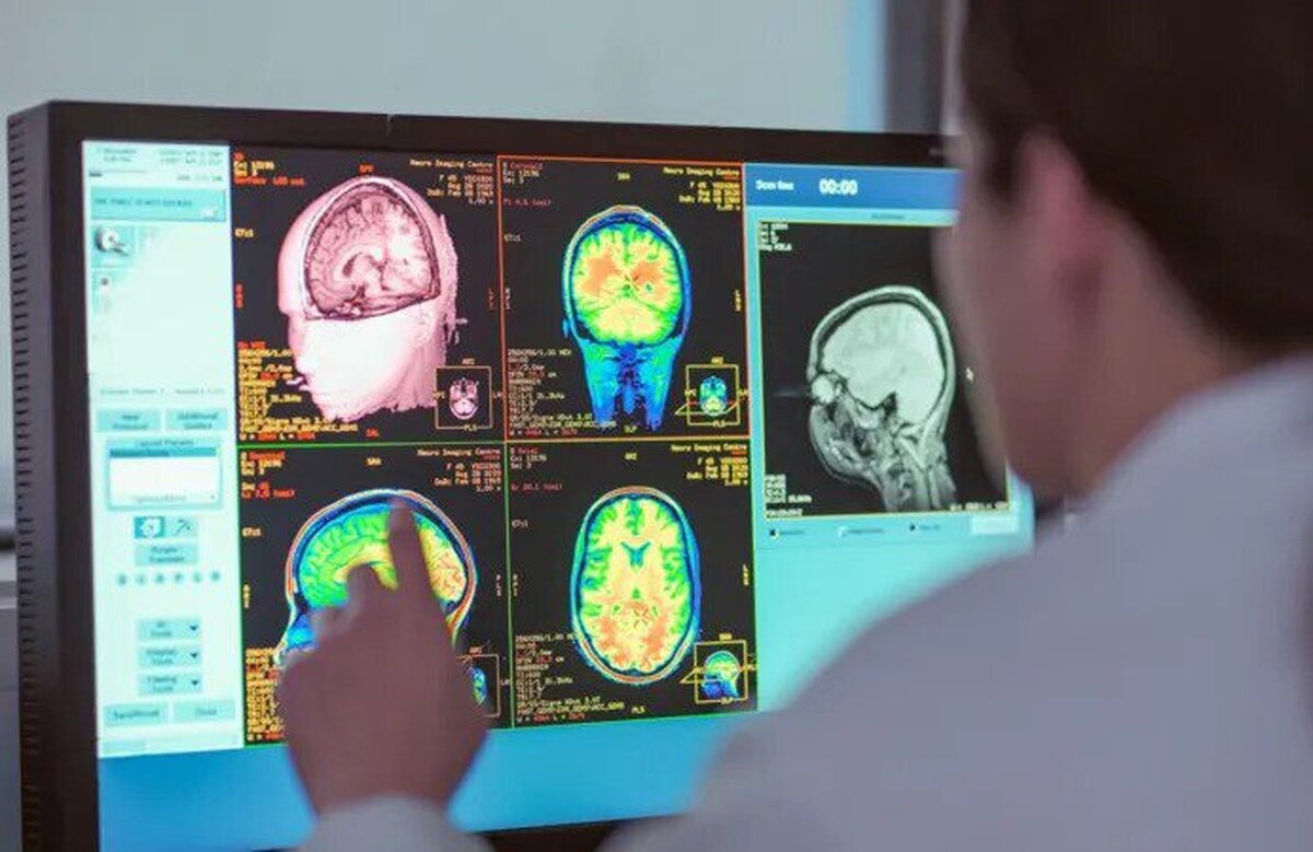 کشفیات جدید درباره پنج مرحله در طول زندگی مغز