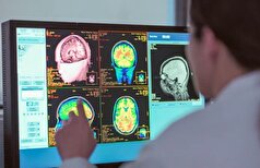 کشفیات جدید درباره پنج مرحله در طول زندگی مغز