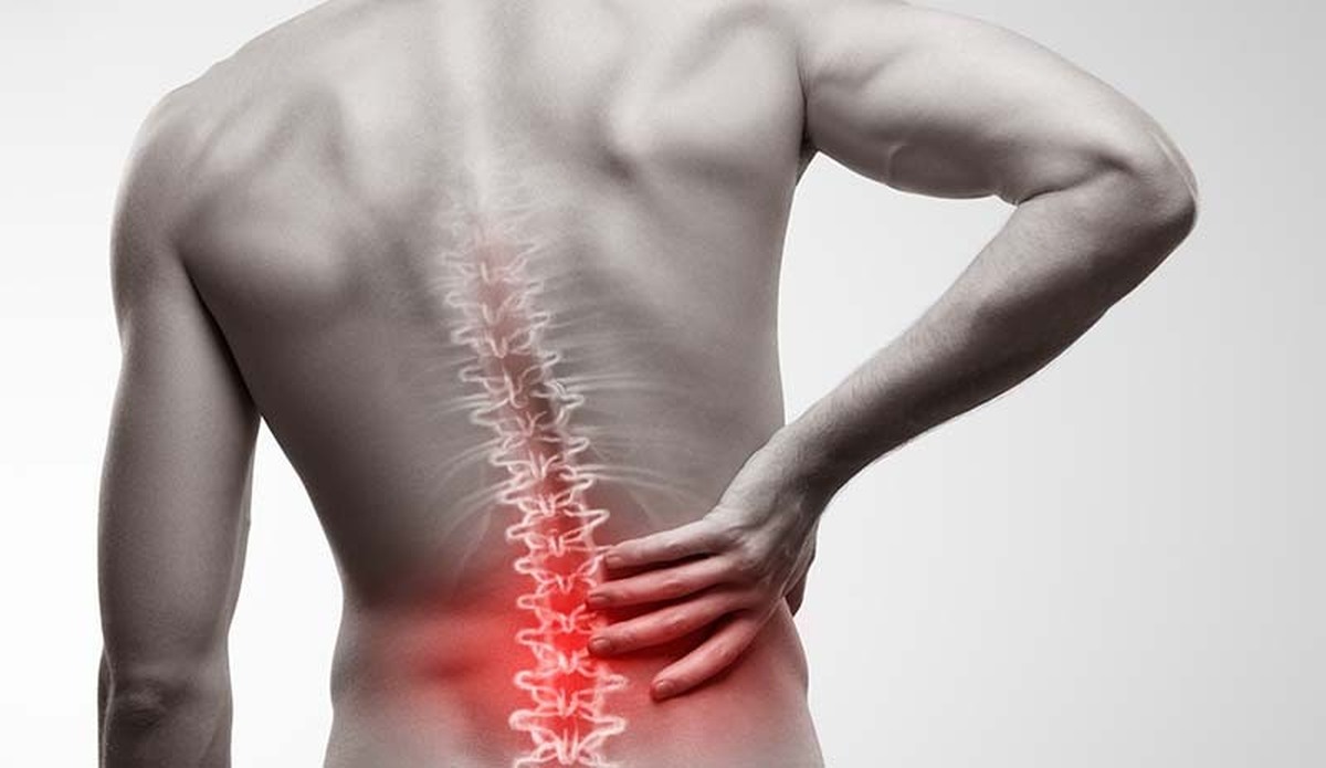 تا سال ۲۰۵۰، ۸۴۳ میلیون نفر ممکن است از کمردرد رنج ببرند.