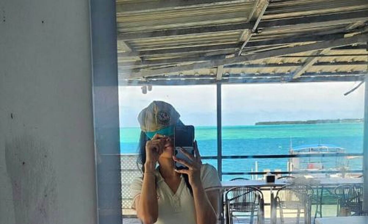 لاغری شدید سویو طرفدارانش را نگران کرد!