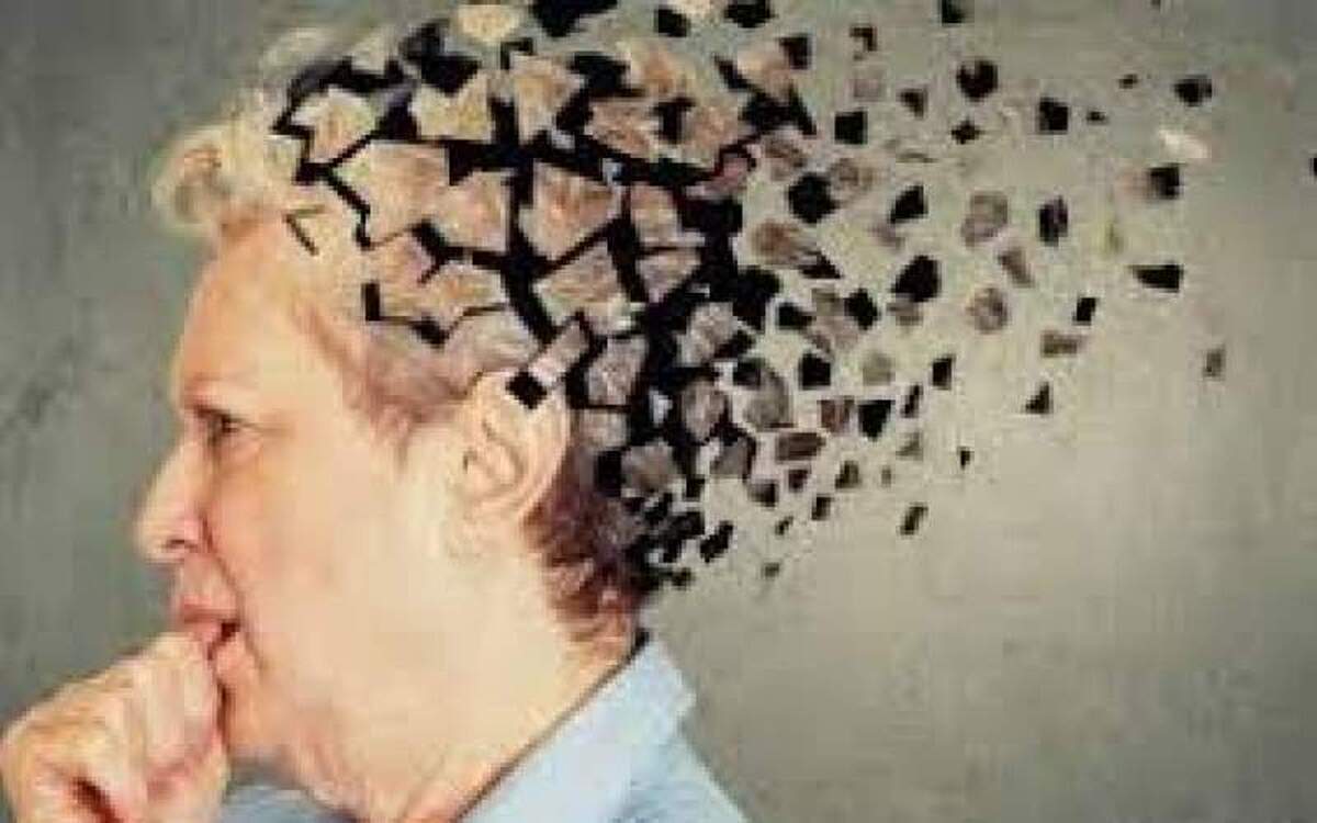 خواب‌آلودگی بیش از حد در زنان مسن نشانه بیماری زوال عقل است!