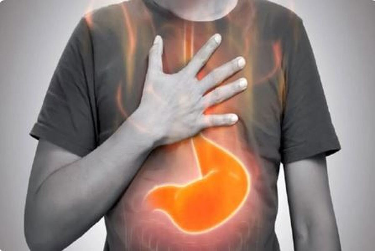 نقش ریفلاکس معده بر شیوع اختلالات خواب