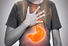 نقش ریفلاکس معده بر شیوع اختلالات خواب