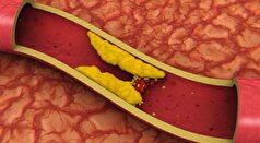 پزشک نوشیدنی تابستانی را برای مبارزه با کلسترول 