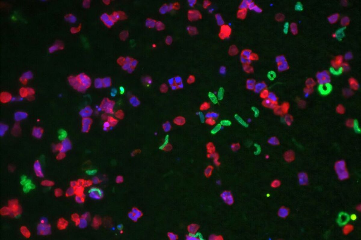 مشخص شده است که باکتری‌ها چگونه لمس را حس می‌کنند.