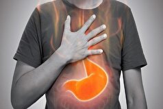 رابطه باور نکردنی ریفلاکس معده و بروز و تشدید اختلالات خواب