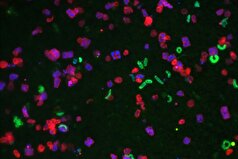 مشخص شده است که باکتری‌ها چگونه لمس را حس می‌کنند.