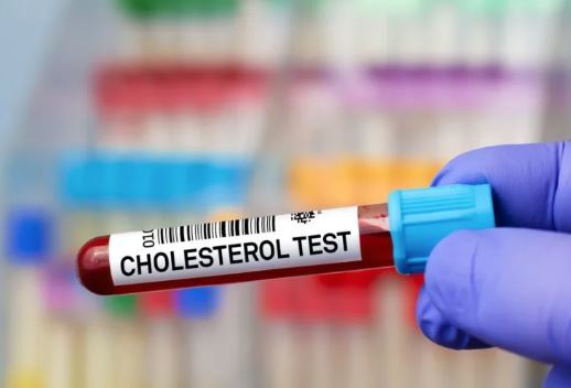 چگونه بدون دارو میزان کلسترول بد بدن مان را پایین بیاوریم؟ چگونه بدون دارو میزان کلسترول بد بدن مان را پایین بیاوریم؟