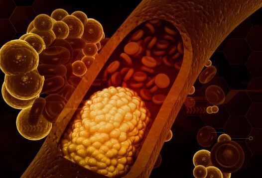 چگونه بدون دارو میزان کلسترول بد بدن مان را پایین بیاوریم؟ چگونه بدون دارو میزان کلسترول بد بدن مان را پایین بیاوریم؟