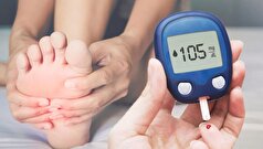 پزشکان توضیح دادند که چگونه می‌توان دیابت را از روی وضعیت پا‌ها تشخیص داد.
