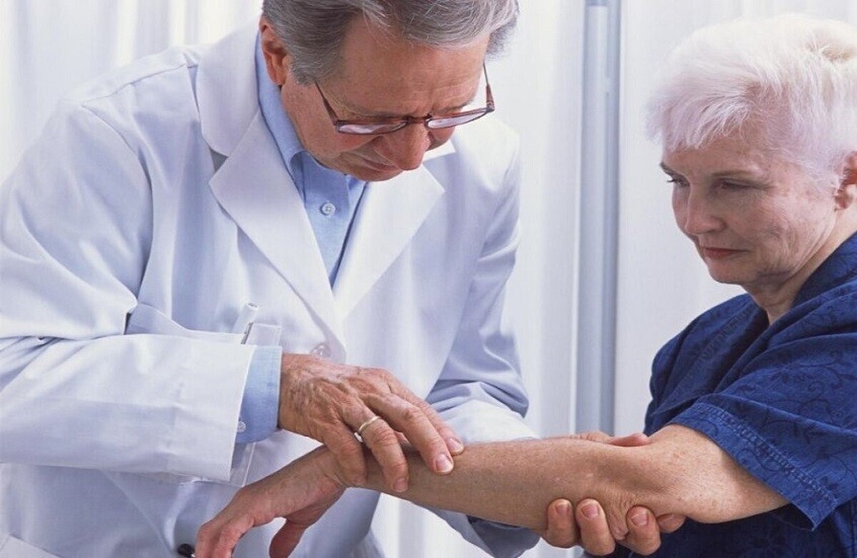 افراد مسن و خارش مزمن... یک مطالعه عوامل مؤثر را روشن می‌کند