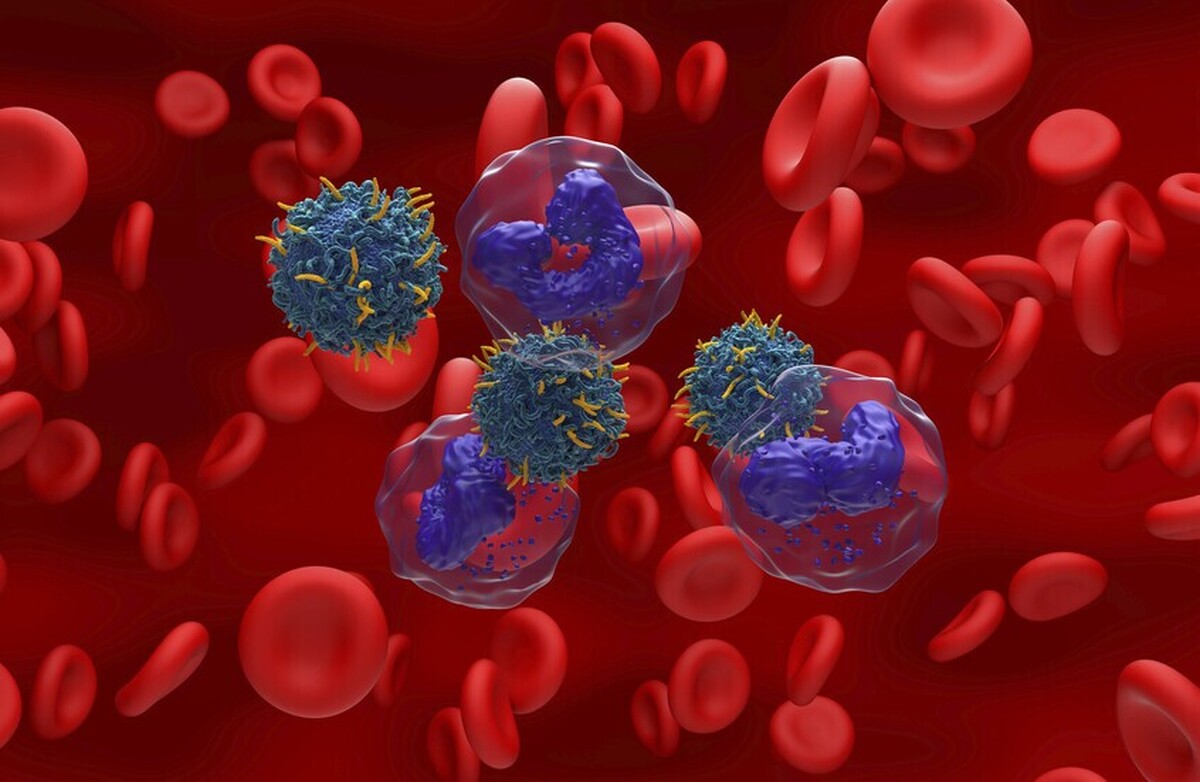 یک ترکیب طبیعی امیدوارکننده، امکاناتی را برای درمان یکی از خطرناک‌ترین انواع سرطان خون (لوسمی) فراهم می‌کند