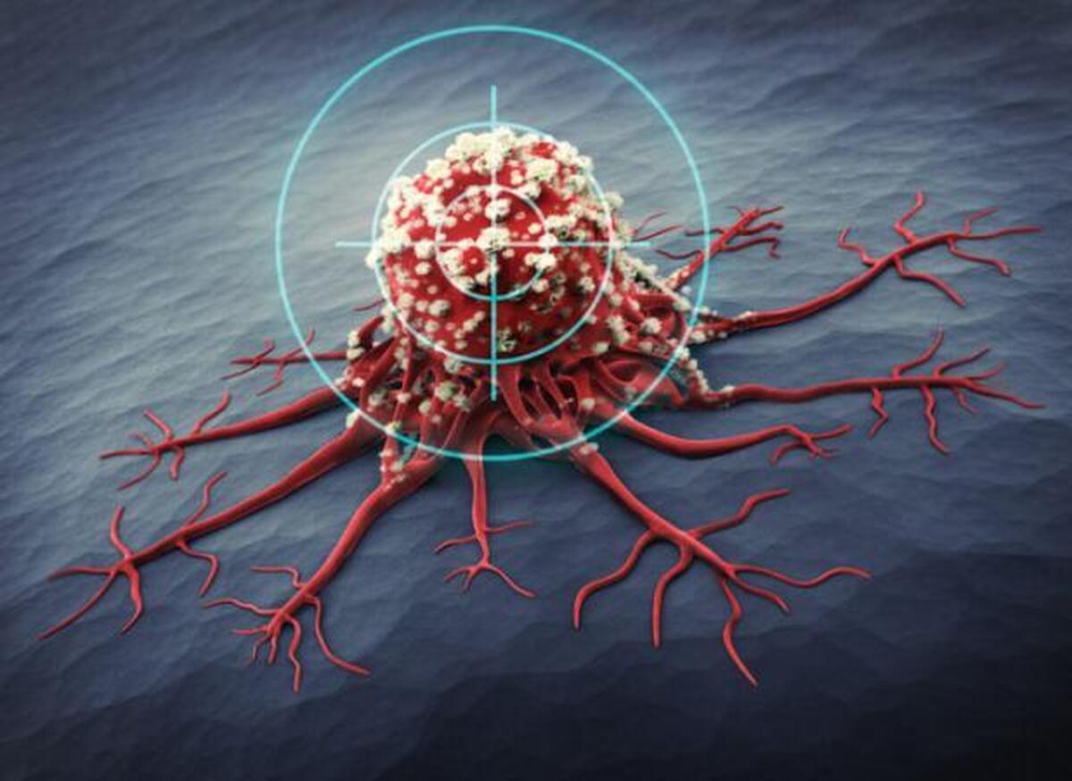 روش جدیدی برای درمان سرطان مستقل از سیستم ایمنی فرد!