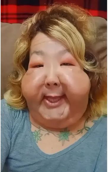 اینفلوئنسر برزیلی بعد از زندگی با یک چهره عجیب بدلیل عمل زیبایی ناموفق خودش را بازسازی کرد!