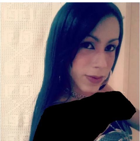 اینفلوئنسر برزیلی بعد از زندگی با یک چهره عجیب بدلیل عمل زیبایی ناموفق خودش را بازسازی کرد!