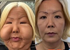 اینفلوئنسر برزیلی بعد از زندگی با یک چهره عجیب بدلیل عمل زیبایی ناموفق خودش را بازسازی کرد!