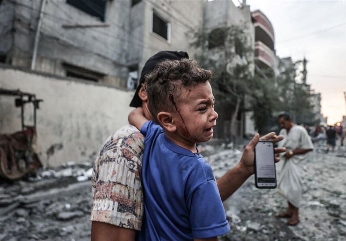 یونیسف: ۹۳۰۰ کودک در نوار غزه دچار سوءتغذیه حاد هستند