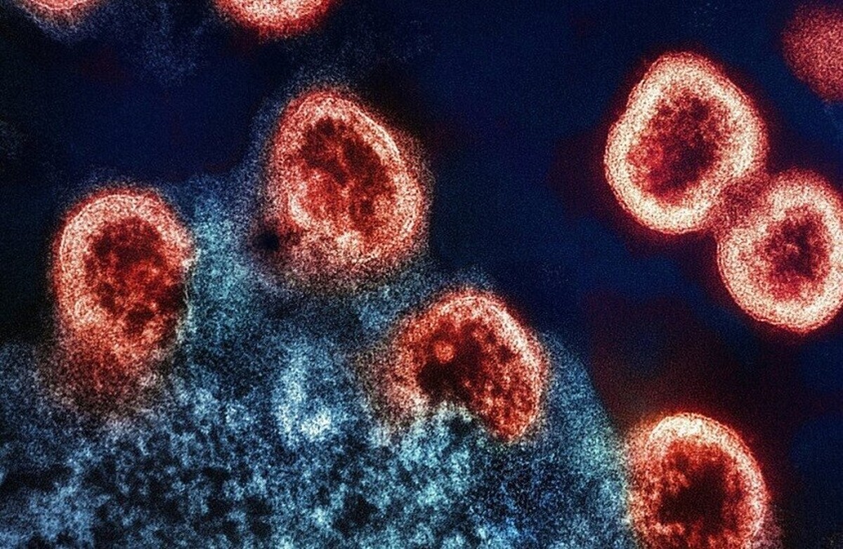 دانشمندان کشف کردند که چرا ریشه‌کن کردن ایدز اینقدر دشوار است!