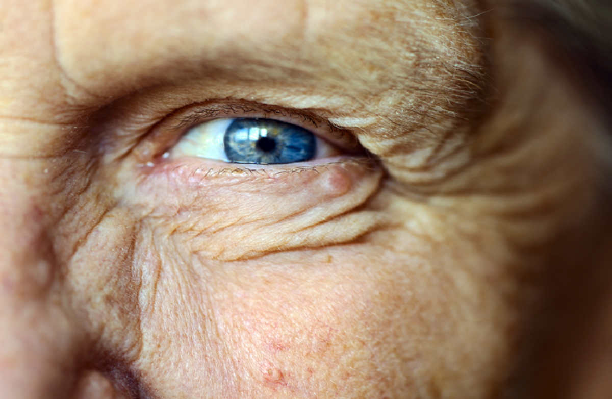 یک رویکرد پیشگیرانه برای کاهش سرعت از دست دادن بینایی مرتبط با سن