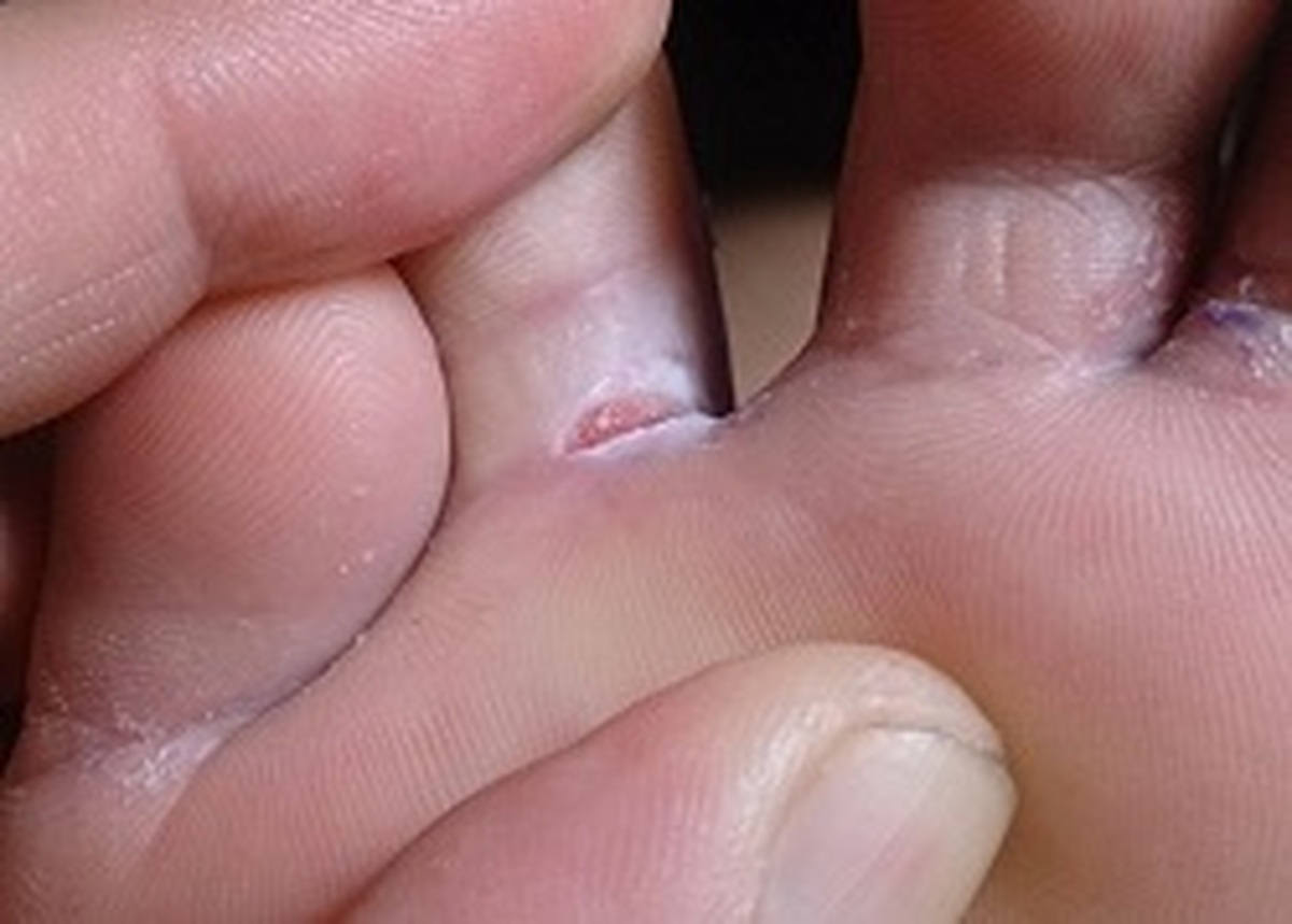 دانشمندان ثابت کرده‌اند که شستن پوست بین انگشتان پا و پشت گوش‌ها ضروری است.