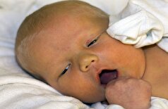 زردی: علل و عوارض آن برای سلامتی