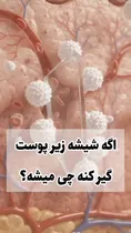 فیلم| اگر شیشه زیر پوستتان بماند، بدن چه واکنشی نشان می‌دهد؟